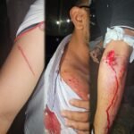 युवती के चक्कर में हुआ छात्रों में विवाद, चले चाकू 